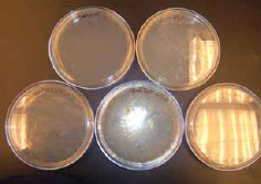 Figure 3.30: It is important to clearly label petri dishes, and to ensure that we have good control samples (water and saline). Image by Dr. Marisa Pedulla. 