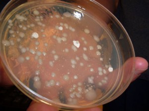 Figure 3.26: A microbial culture on a Petri dish. Image by Dr. Marisa Pedulla. 
