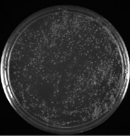Figure 3.37: And, shockingly, our GOOD sample plus 5 drops of bleach had about the same number of colonies as our GOOD sample without bleach. Image by Dr. Marisa Pedulla.